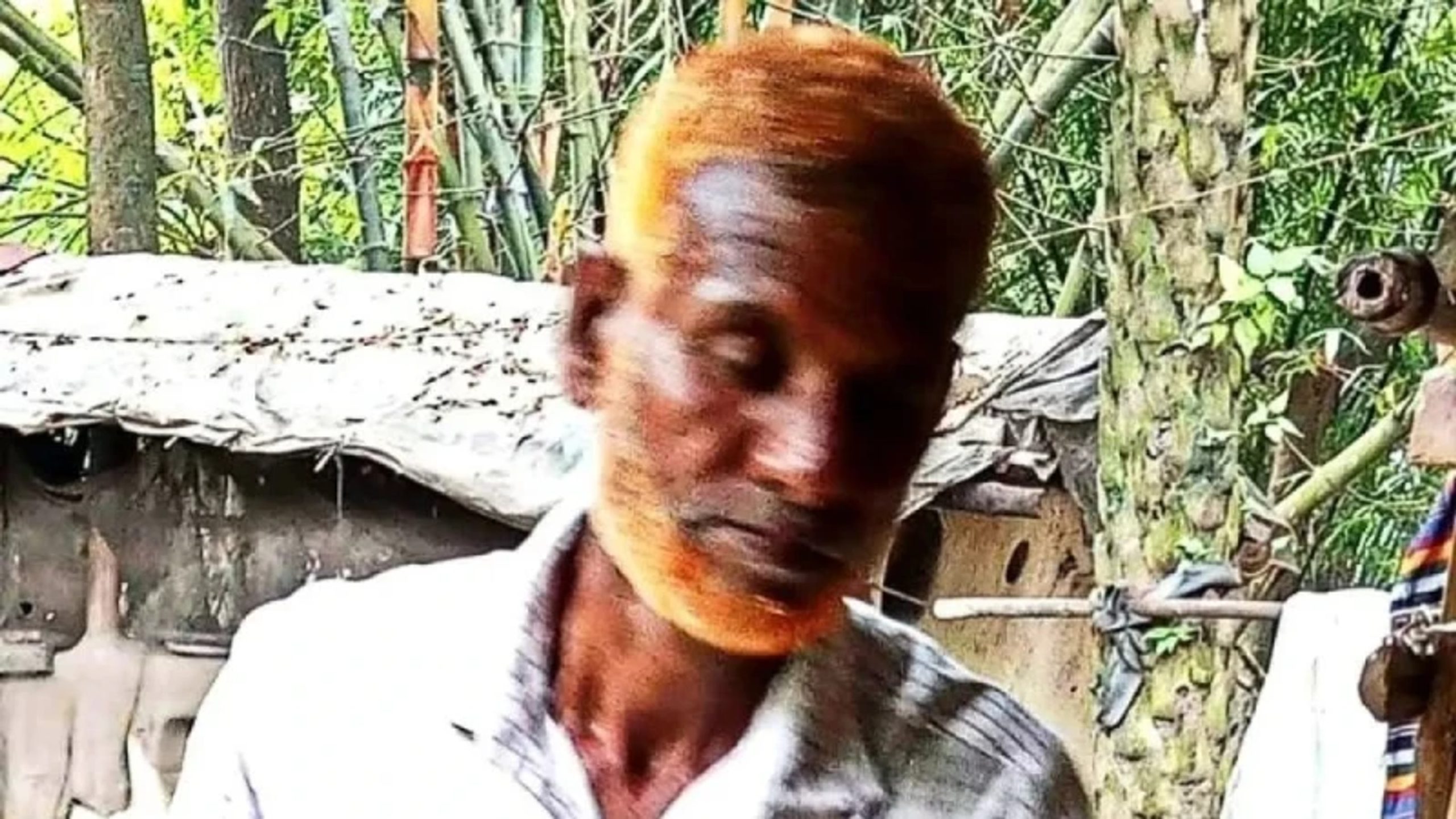 শ্বাসনালীতে আমের আঁটি আটকে বৃদ্ধের মৃত্যু