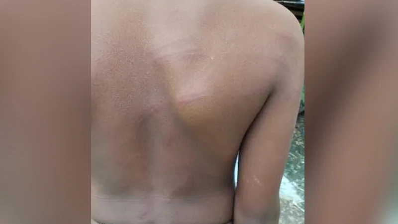 মাদ্রাসাছাত্রকে হাত-পা বেঁধে পেটানোর অভিযোগ