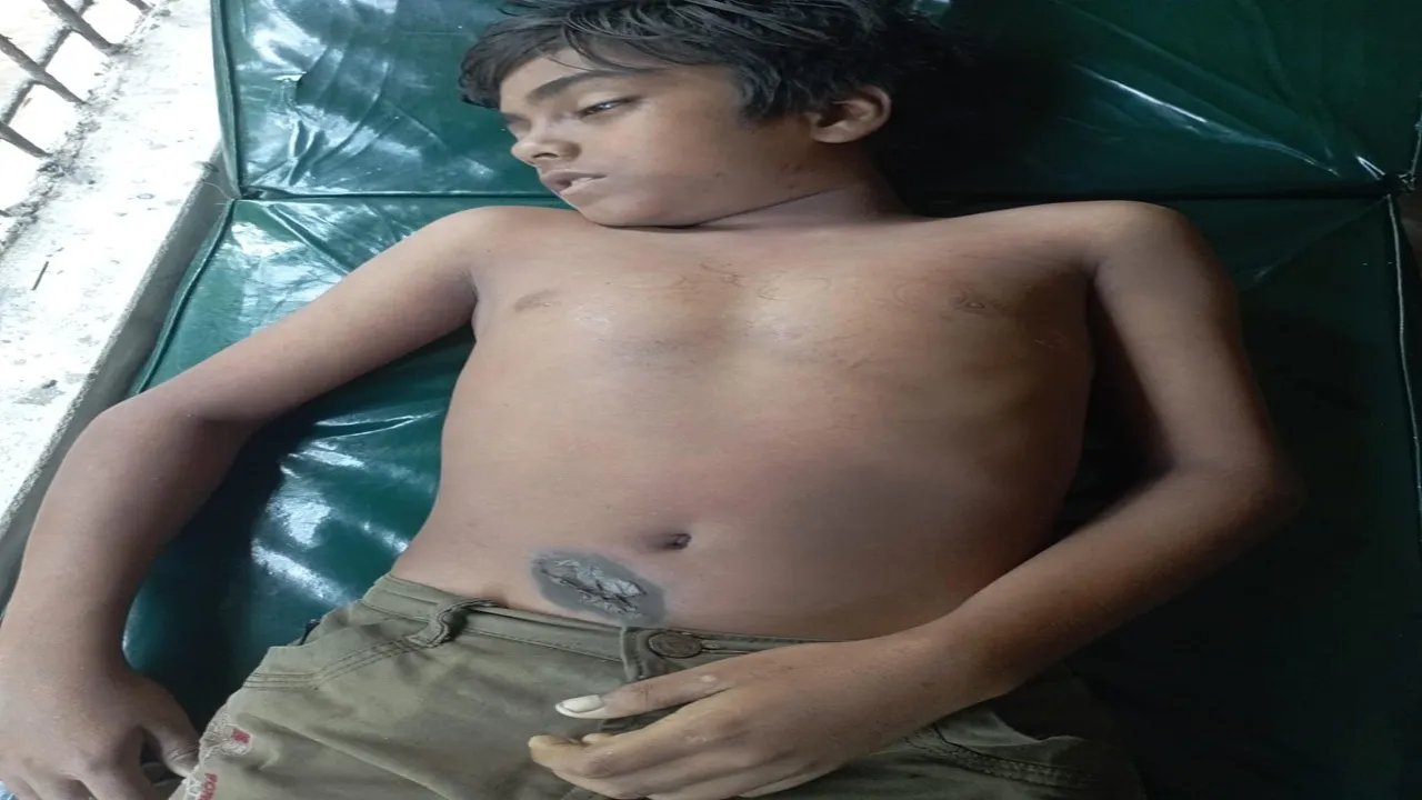নলছিটিতে অটোরিকশা চার্জের সময় বিদ্যুৎস্পৃষ্টে শিশুর মৃত্যু, গুরুতর আহত আরেক শিশু